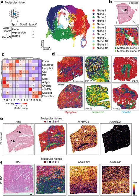 Characteristic Tissue Structures Inferred From Spatial Transcriptomics