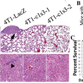 Bone Metastasis And Lesions Of Primary Mammary Tumors Derived From