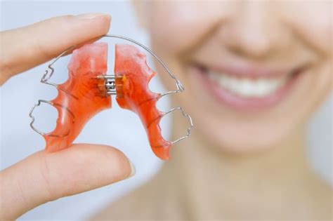 Tips For Taking Care Of Retainers Milnor Orthodontics Fort Collins