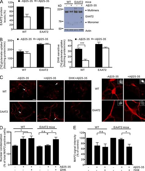 Increased Eaat Expression Significantly Protected Against