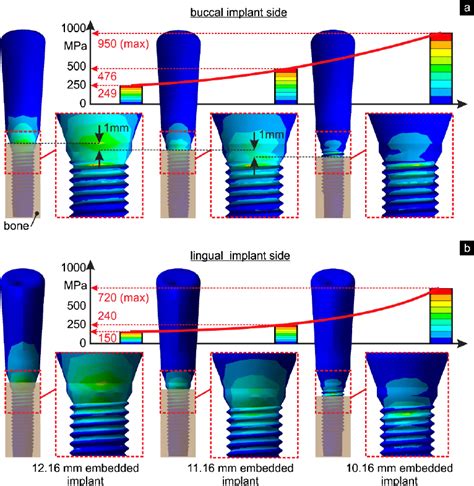 Fem Calculated Stress Distribution Of The Endosteal Implant Subjected Download Scientific