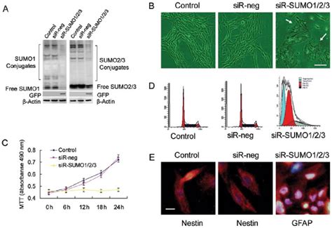 Small Ubiquitin Like Modifiers SUMOs Are Essential For Bone