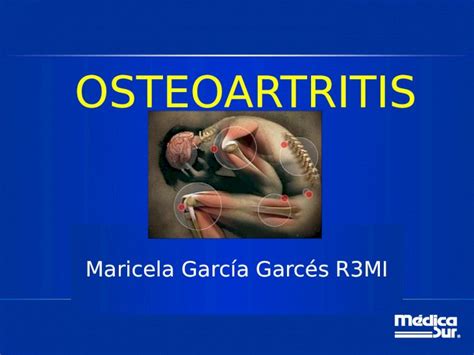 Ppt Osteoartritis Maricela Garc A Garc S R Mi Puntos A Tratar