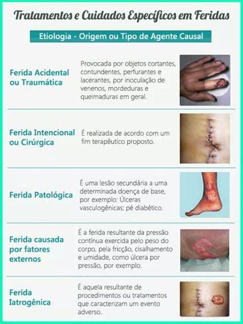 Tipos De Feridas Na Pele