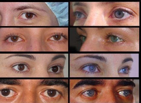 Eye Colors: How to Permanently Change Eye Color