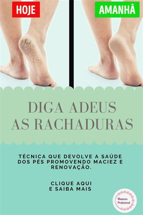 Técnica Que Hidrata E Regenera Os Pés Ressecados Eliminando Calos E Rachaduras Manicure E