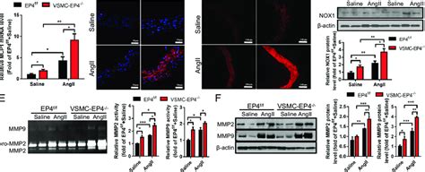 Vsmc Specific Deletion Of Ep Results In Increased Vascular