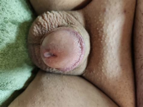 Small Cock Pre Cum 5 Nude Pics XHamster
