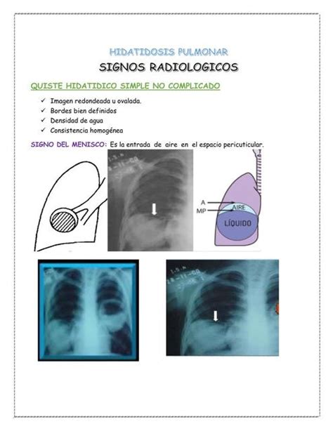 Signos Radiol Gicos Cyan Udocz