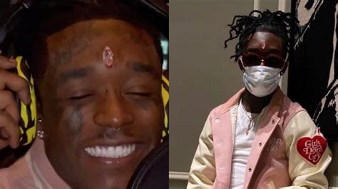 Us Rapper Lil Uzi Vert Gets N9 Billion Pink Diamond Implanted On His Forehead Video Intel Region