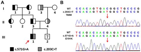 A Compound Heterozygous Mutation Of The Alkaline Phosphatase Alpl Gene