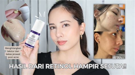 Pemula Mau Pake Retinol Wajib Tau Ini Kiehls Micro Dose Retinol