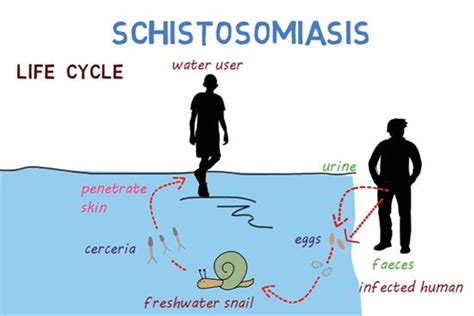 Schistosomiasis Bilharzia