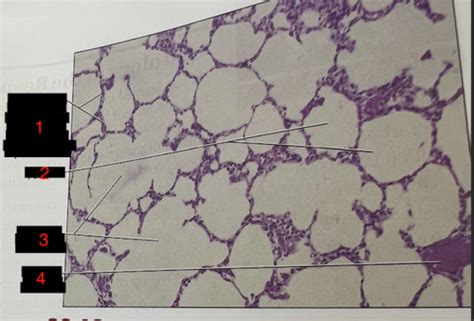 A P Ii Alveoli And Lung Tissue Histology Labeling Flashcards Quizlet