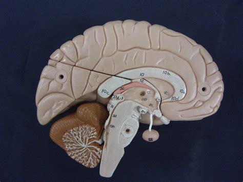 BIO 201 LAB 3 Brain Structures Associated With Ventricles Diagram Quizlet