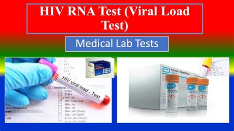 HIV RNA Test Viral Load Test Medical Lab Tests What Is Uses