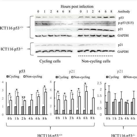 Western Blot Analysis Of P53 P P53 S15 And P21 Proteins In Hiv 1 Download Scientific Diagram