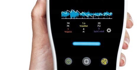 New Study Investigates Utility of Pulse Oximetry to Screen Children ...