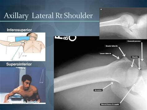 PPT - Shoulder girdle PowerPoint Presentation, free download - ID:5415018