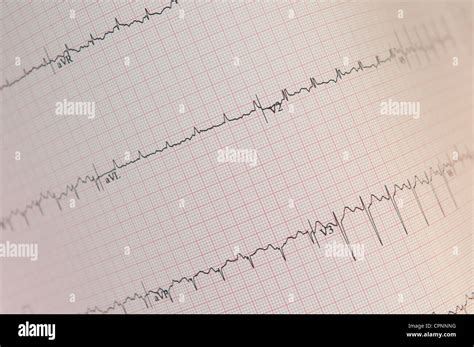 Ecg Stock Photo Alamy