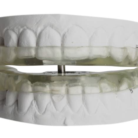 Orthodontics And Tmj Sleep Appliances Gergen S Orthodontic Lab