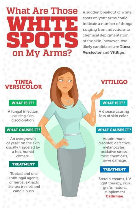 Tinea Versicolor Causes Symptoms Treatment Artofit