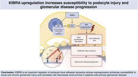 Jci Insight Kibra Upregulation Increases Susceptibility To Podocyte