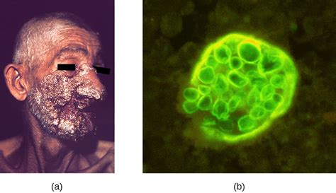 Respiratory Mycoses · Microbiology