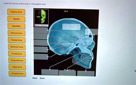 Solved Label The Bones Of The Skull In Midsagittal View Palatine Bone