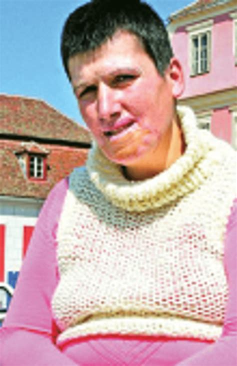 Exclusiv EvZ De ce s a oprit profesorul Ioan Lascăr din a mai face operații de schimbare de sex