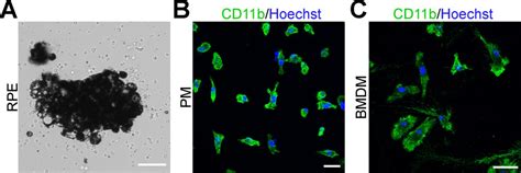 Tpc Promotes Choroidal Angiogenesis And Inflammation In A Mouse Model