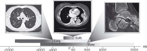 Computed Tomography Ct Radiology Key