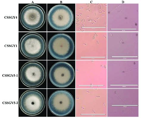 Morphological Characteristics Of Colonies Conidia And Appressoria Of