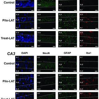 The effects of anakinra treatment on the distribution of neuronal ...