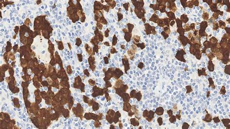 Milieu R Actionnel Alk Leica Biosystems Pour Immunohistochimie