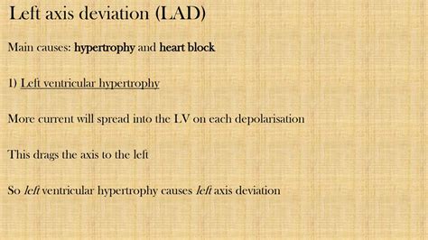 Lecture 2 Why Do Ecgs Look Like They Do Part Ppt Download