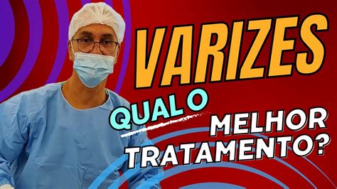 O Melhor Tratamento Para Varizes YouTube