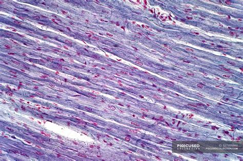 Músculo cardíaco humano micrografía ligera Tinción de hematoxilina y