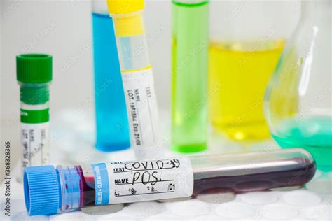 Corona Virus Ncov And Covid Positive Test Samples Blood Tube