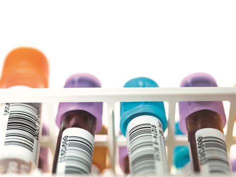 Fda Relaxes Blood Donation Restrictions On Gay Men Modern Healthcare