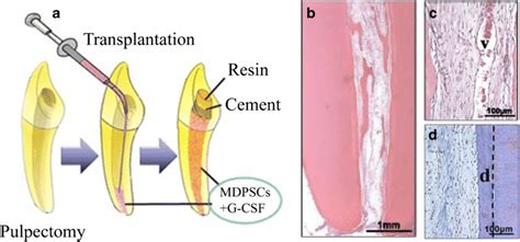 Dental Pulp Engineering Schematic Of Dentin Pulp Complex Engineering