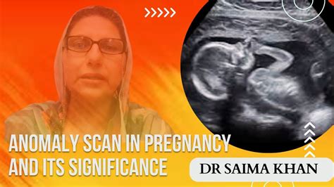 Anomaly Scan In Pregnancy And Its Significance Dr Saima Khan Youtube