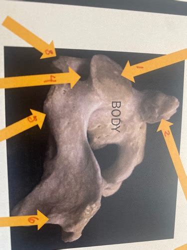 Cervical Vertebrae C2 Axis Flashcards Quizlet