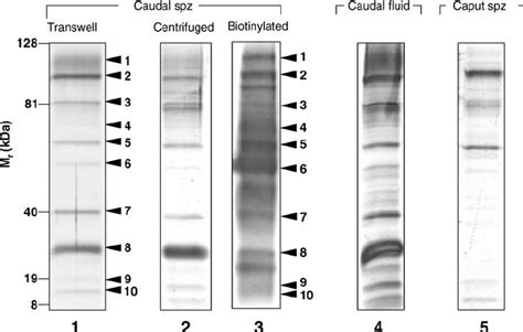 Electrophoretic Profile Of Proteins Isolated From Mouse Spermatozoa