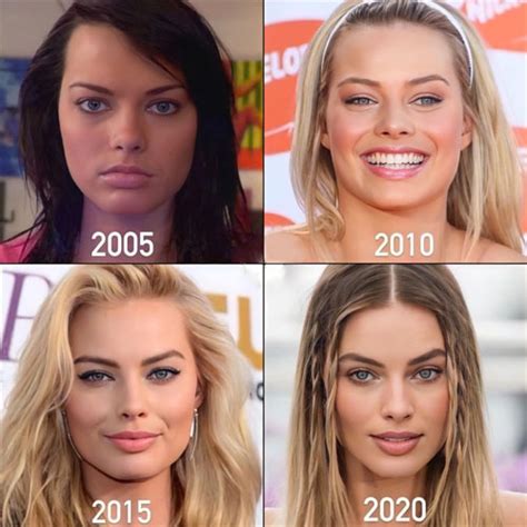 Margot Robbie Une Barbie Made Of Plastic Surgery