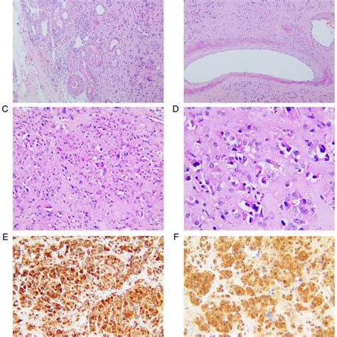 Histological And Immunohistochemical Characterization Of The Ovarian