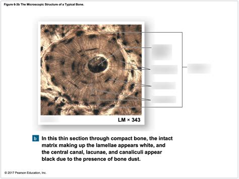 Skeletal Microscopic Structure Of Typical Bone Diagram Quizlet