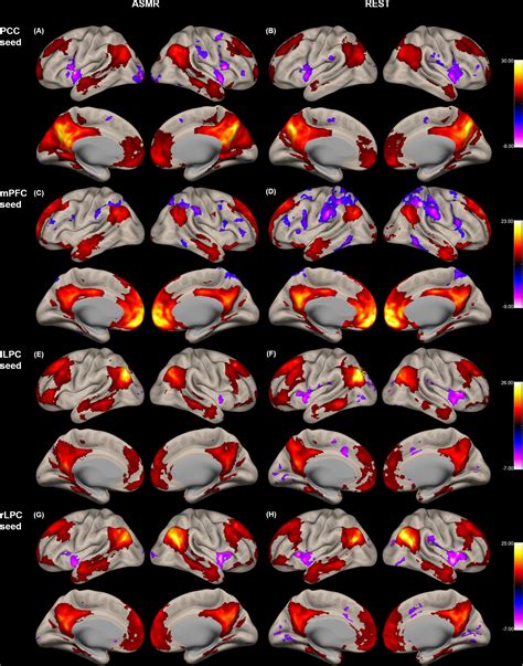 Frontiers | Effects of Autonomous Sensory Meridian Response on the