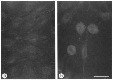 Inhibition of CAAX-dependent prenyltransferases causes morphologic ... 