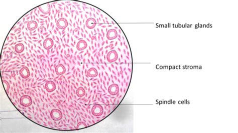 Endometrium Proliferative Phase Pathology Made Simple